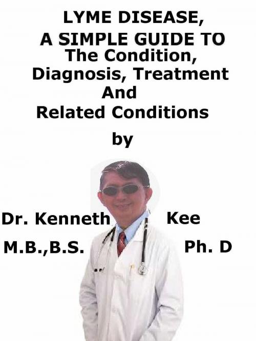 Cover of the book Lyme Disease A Simple Guide To The Condition, Diagnosis, Treatment And Related Conditions by Kenneth Kee, Kenneth Kee