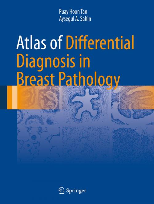 Cover of the book Atlas of Differential Diagnosis in Breast Pathology by Puay Hoon Tan, Aysegul A. Sahin, Springer New York