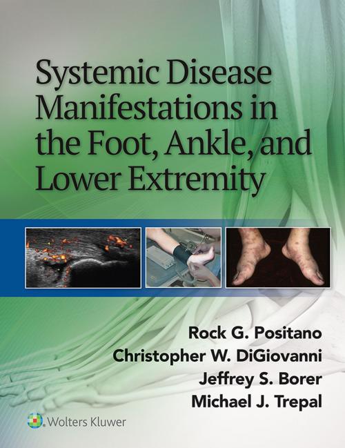 Cover of the book Systemic Disease Manifestations in the Foot, Ankle, and Lower Extremity by Rock G. Positano, Jeffrey Borer, Christopher DiGiovanni, Michael Trepal, Wolters Kluwer Health