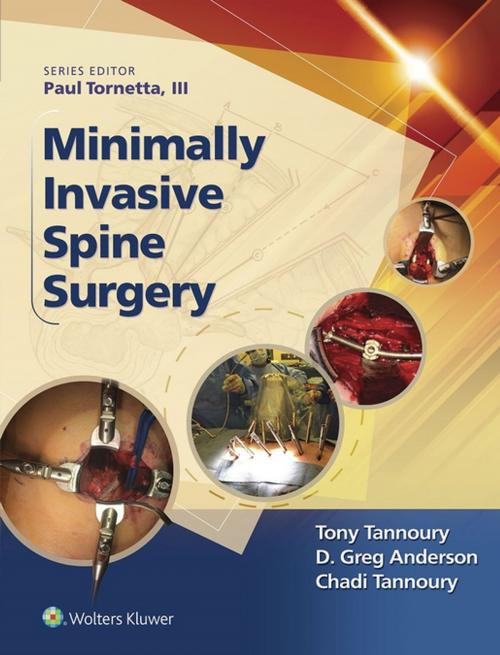 Cover of the book Minimally Invasive Spine Surgery by Chadi Tannoury, Wolters Kluwer Health