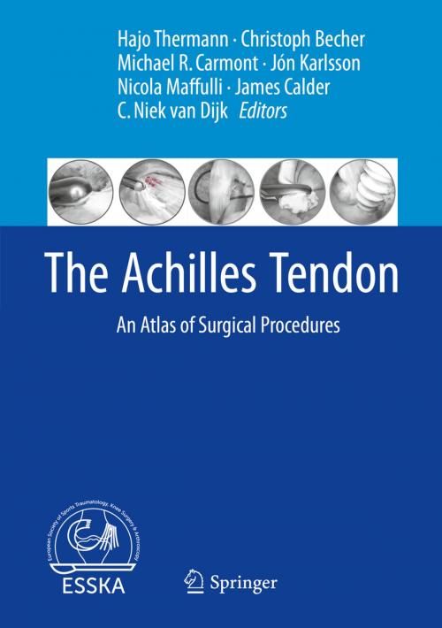 Cover of the book The Achilles Tendon by , Springer Berlin Heidelberg