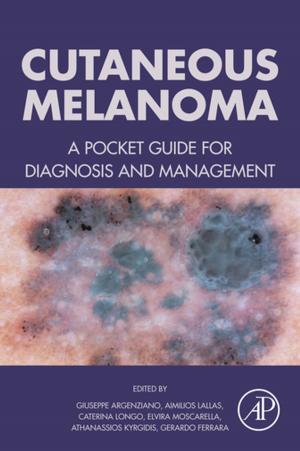 Cover of the book Cutaneous Melanoma by Jeremy D. Schmahmann