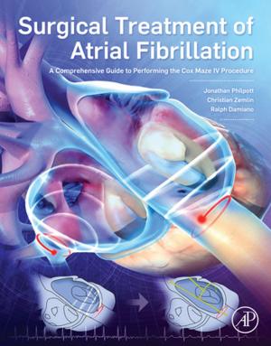 Cover of the book Surgical Treatment of Atrial Fibrillation by Peter R. N. Childs, BSc.(Hons), D.Phil, C.Eng, F.I.Mech.E., FASME, FRSA