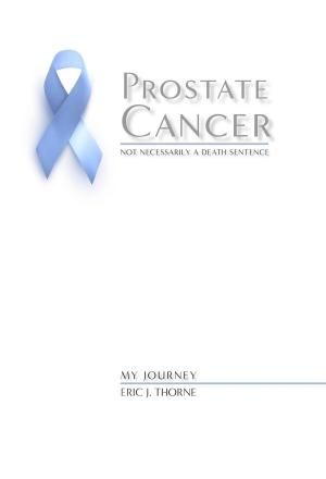 Book cover of Prostate Cancer