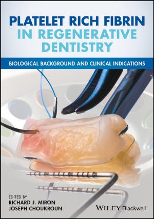 Cover of the book Platelet Rich Fibrin in Regenerative Dentistry by Marc Van De Mieroop