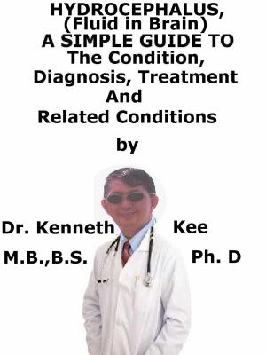 Cover of the book Hydrocephalus, (Fluid in Brain) A Simple Guide To The Condition, Diagnosis, Treatment And Related Conditions by Kenneth Kee