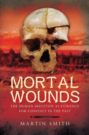 Book cover of Mortal Wounds