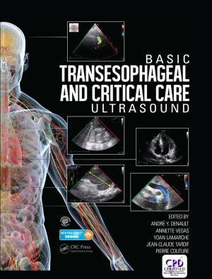 Cover of the book Basic Transesophageal and Critical Care Ultrasound by Jean-Pierre Adloff