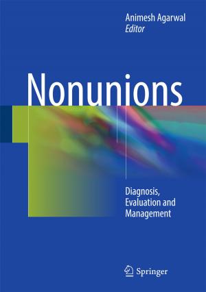 Cover of the book Nonunions by Gudmund J.W. Smith