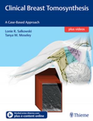 Book cover of Clinical Breast Tomosynthesis