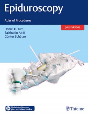 Cover of the book Epiduroscopy by George Laskaris