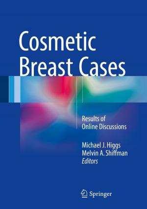 Cover of the book Cosmetic Breast Cases by Anatoly A. Martynyuk