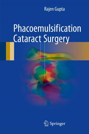 Cover of the book Phacoemulsification Cataract Surgery by Alberto Baracco