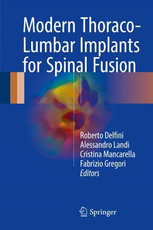 Cover of the book Modern Thoraco-Lumbar Implants for Spinal Fusion by Kalevi Holsti