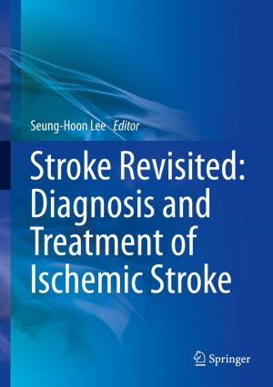 Cover of the book Stroke Revisited: Diagnosis and Treatment of Ischemic Stroke by Tadahisa Funaki
