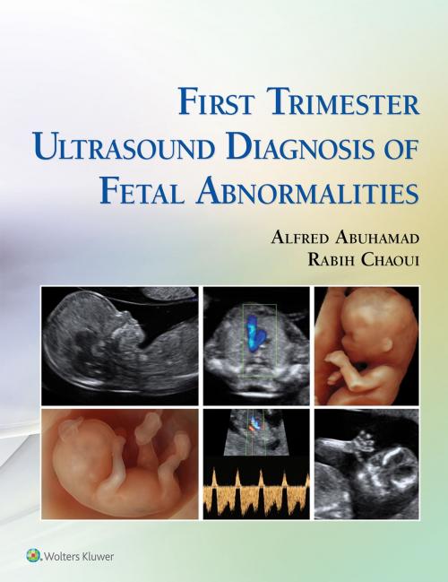 Cover of the book First Trimester Ultrasound Diagnosis of Fetal Abnormalities by Alfred Z. Abuhamad, Rabih Chaoui, Wolters Kluwer Health