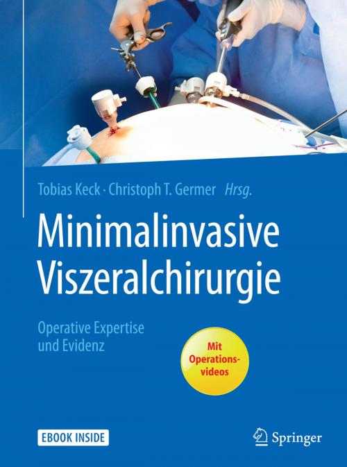 Cover of the book Minimalinvasive Viszeralchirurgie by , Springer Berlin Heidelberg