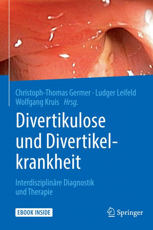Cover of the book Divertikulose und Divertikelkrankheit by , Springer Berlin Heidelberg