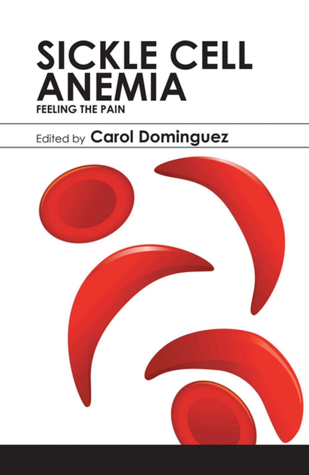 Big bigCover of Sickle Cell Anemia