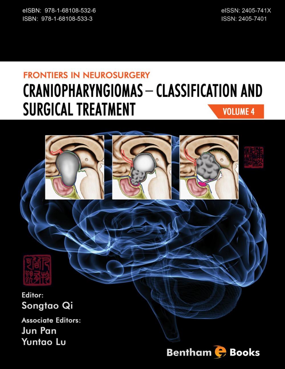 Big bigCover of Frontiers in Neurosurgery Volume 4