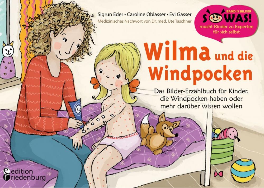 Big bigCover of Wilma und die Windpocken - Das Bilder-Erzählbuch für Kinder, die Windpocken haben oder mehr darüber wissen wollen