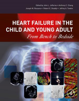 Cover of the book Heart Failure in the Child and Young Adult by S.E. Jorgensen