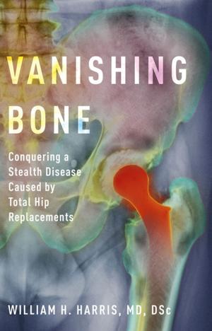 Book cover of Vanishing Bone