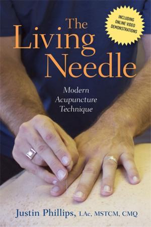 Cover of the book The Living Needle by Joanne Lara