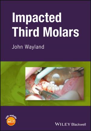 Cover of the book Impacted Third Molars by John Boulmetis, Phyllis Dutwin
