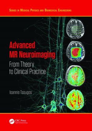 Cover of the book Advanced MR Neuroimaging by Sukh Dev