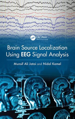 Cover of the book Brain Source Localization Using EEG Signal Analysis by Ahlam I. Shalaby
