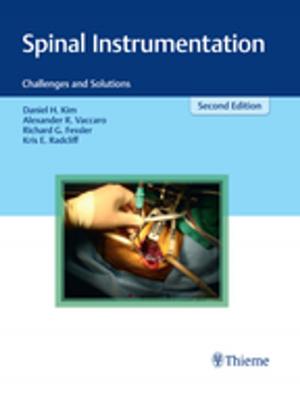 Cover of the book Spinal Instrumentation by Uwe Fischer, Friedemann Baum, Susanne Luftner-Nagel