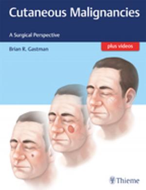 Cover of the book Cutaneous Malignancies by Jaime Tisnado, Philip C. Pieters, Matthew A. Mauro
