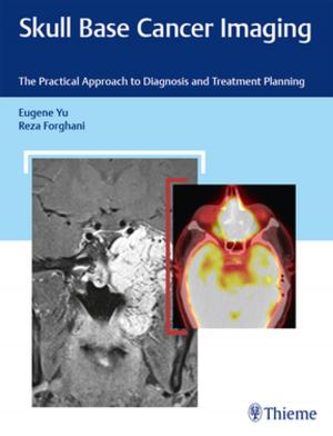 Cover of the book Skull Base Cancer Imaging by Dariush Nikkhah