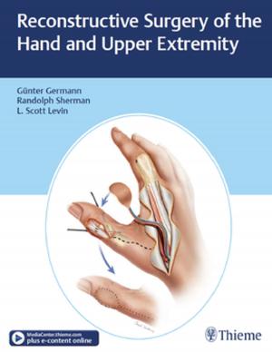 Cover of the book Reconstructive Surgery of the Hand and Upper Extremity by Werner Goetz Hosemann, R. K. Weber