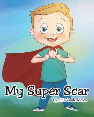 Book cover of My Super Scar