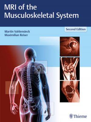 Cover of the book MRI of the Musculoskeletal System by Erich Burghardt, Hellmuth Pickel
