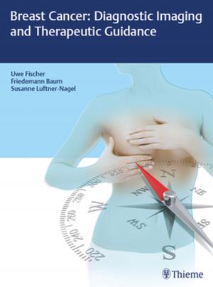 Cover of the book Breast Cancer: Diagnostic Imaging and Therapeutic Guidance by Thanh Hoang-Xuan, Catherine Creuzot-Garcher