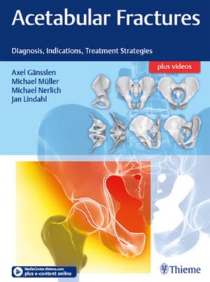 Cover of the book Acetabular Fractures by Remi Nader, Mark Shaya, Cristian Gragnaniello