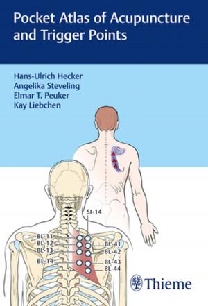 Cover of the book Pocket Atlas of Acupuncture and Trigger Points by Robert F. Spetzler, W. Koos, Johannes Lang