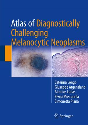 Book cover of Atlas of Diagnostically Challenging Melanocytic Neoplasms