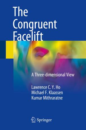 Cover of the book The Congruent Facelift by Timm Krüger, Halim Kusumaatmaja, Alexandr Kuzmin, Orest Shardt, Goncalo Silva, Erlend Magnus Viggen