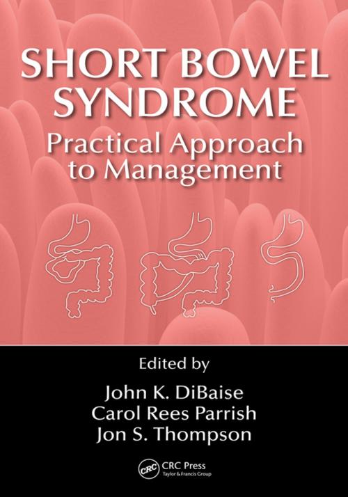 Cover of the book Short Bowel Syndrome by , CRC Press
