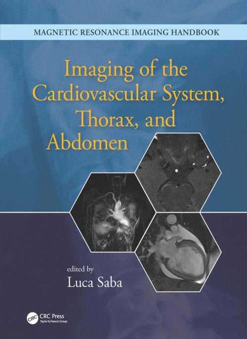 Cover of the book Imaging of the Cardiovascular System, Thorax, and Abdomen by , CRC Press
