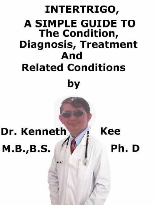 Cover of the book Intertrigo, A Simple Guide To The Condition, Diagnosis, Treatment And Related Conditions by Kenneth Kee, Kenneth Kee