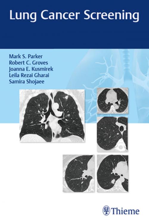 Cover of the book Lung Cancer Screening by Robert Groves, Mark Parker, Joanna Kusmirek, Thieme