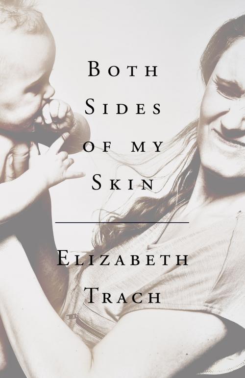 Cover of the book Both Sides of My Skin by Elizabeth Trach, Annorlunda Books