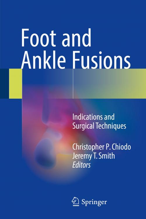 Cover of the book Foot and Ankle Fusions by , Springer International Publishing