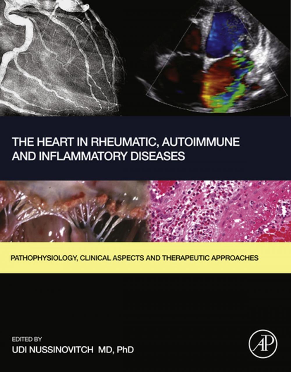 Big bigCover of The Heart in Rheumatic, Autoimmune and Inflammatory Diseases