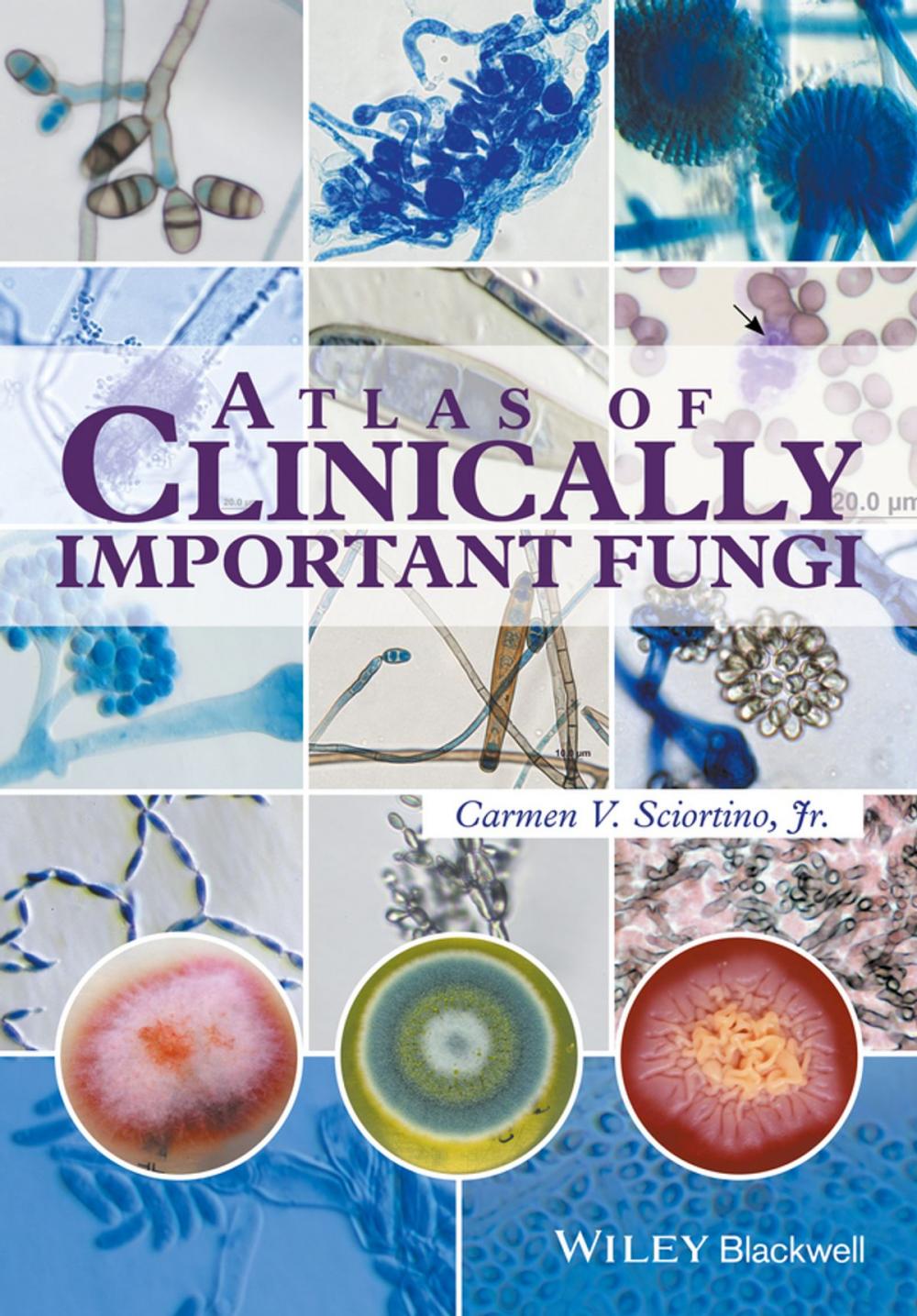 Big bigCover of Atlas of Clinically Important Fungi